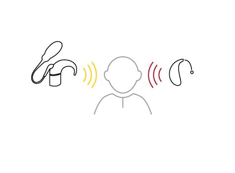 Esquema de la solución coclear bimodal de ReSound.