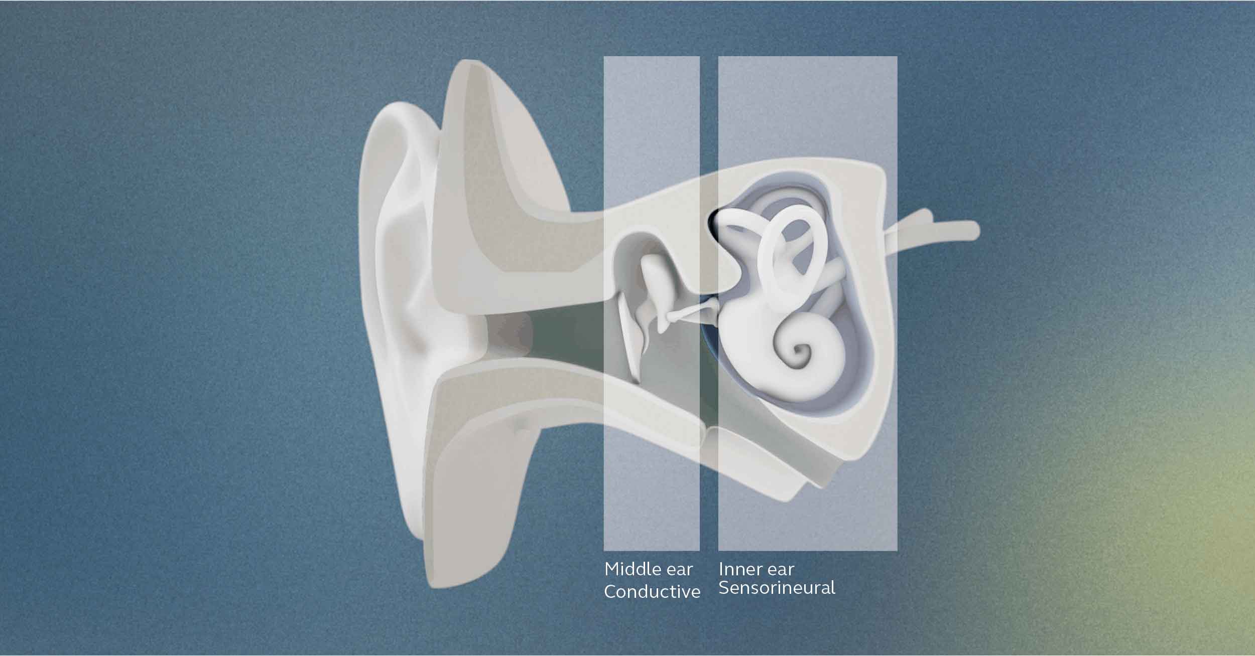 Anatomia da orelha e níveis de perda auditiva.