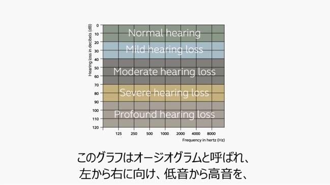 聴力レベル
